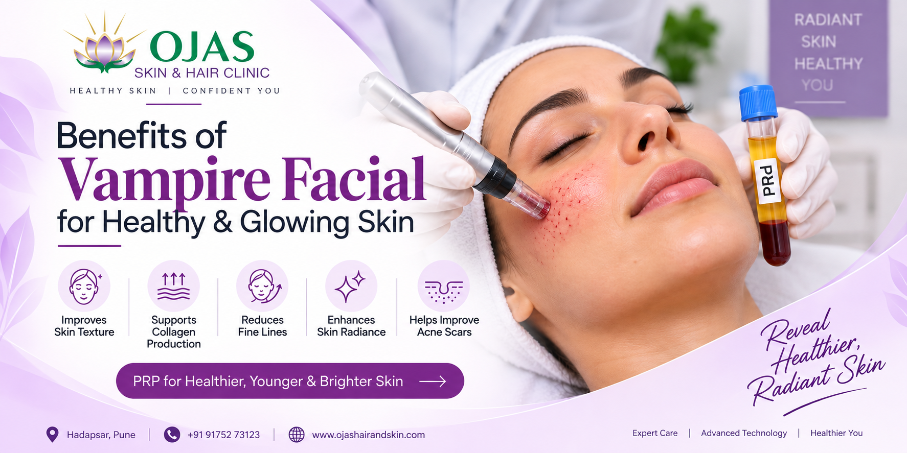 Vampire facial for glowing skin
