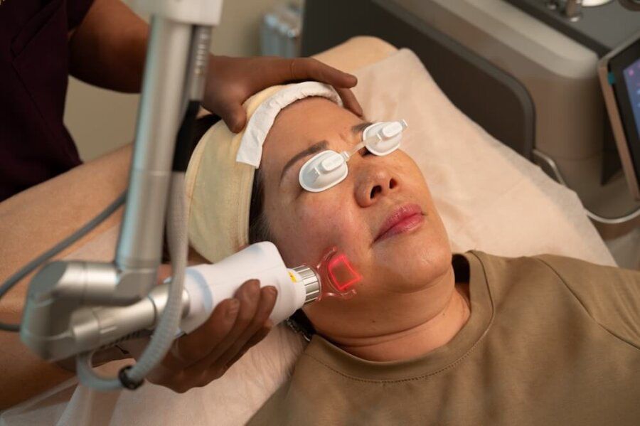 CO2 Laser Treatment for Acne
